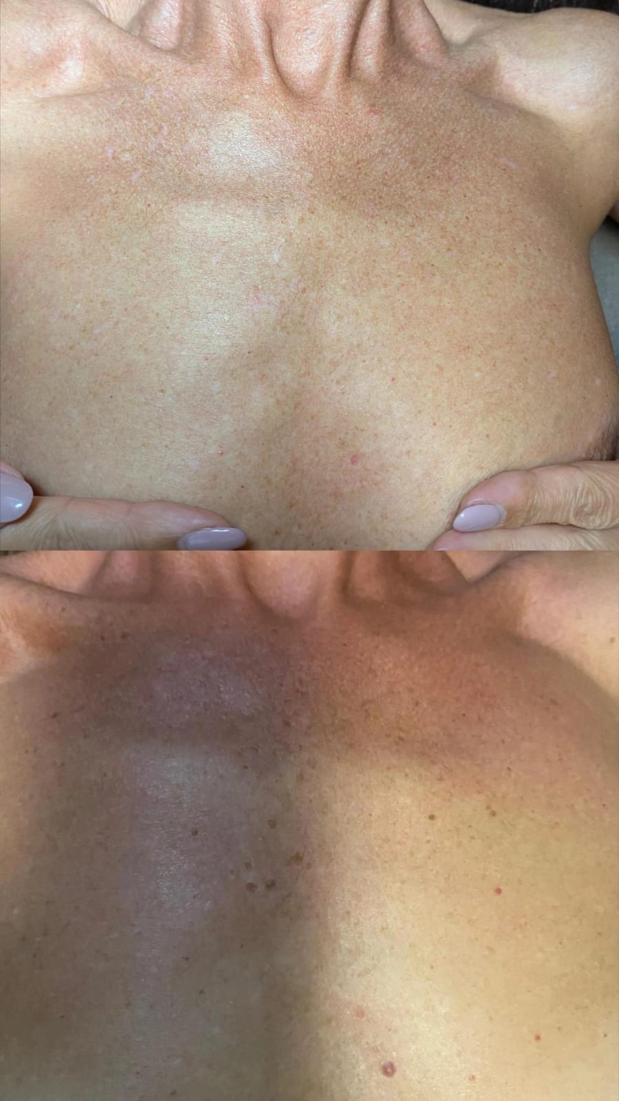 Behandlungsergebnis