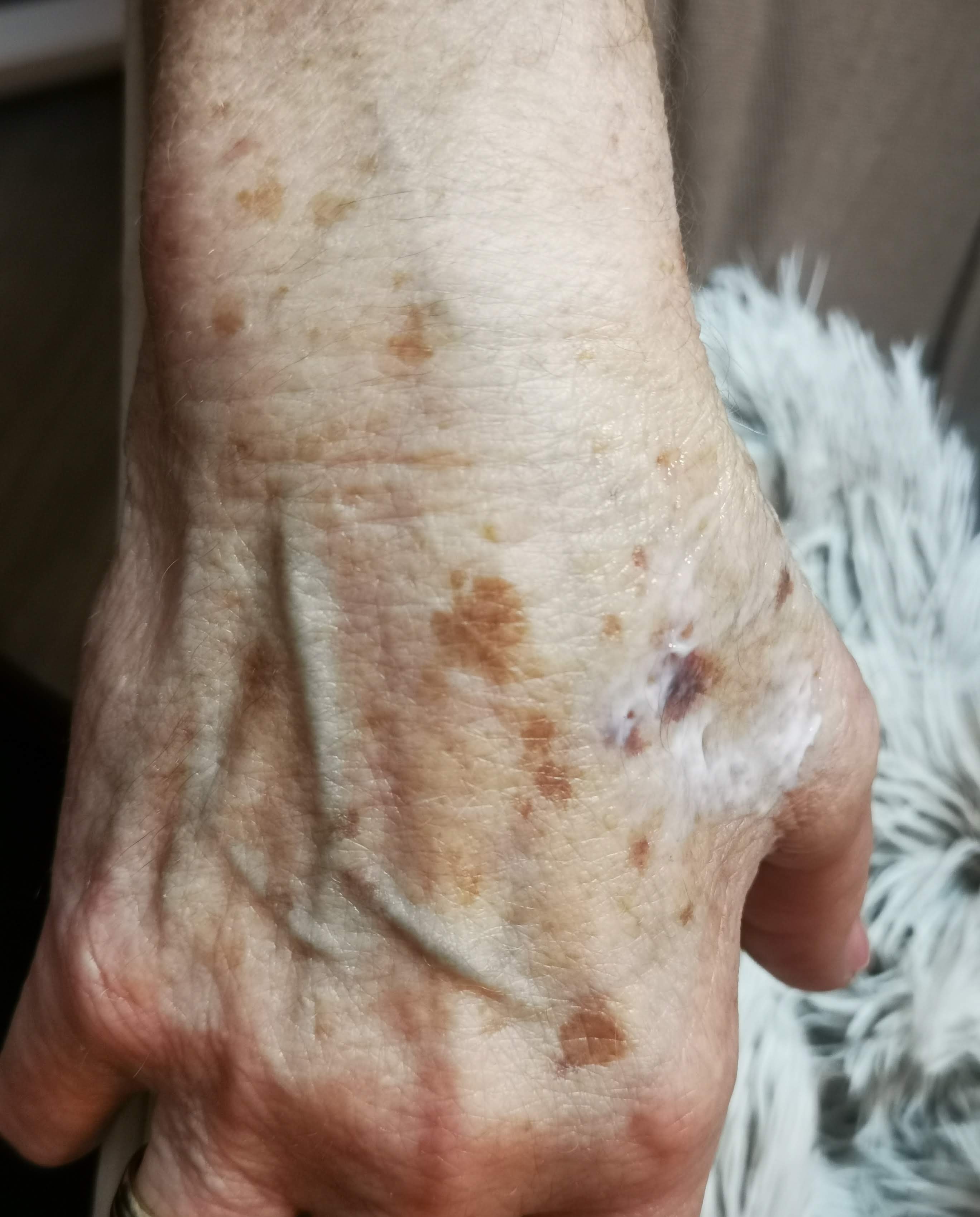 Behandlungsergebnis